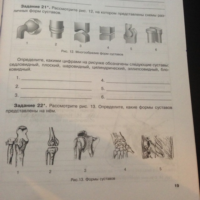 По рисункам определи какая будет. Многообразие форм суставов. Рассмотрите рисунок .какие суставы. Рассмотрим задание. Изучите виды и формы суставов и сделайте подписи к рисунку.